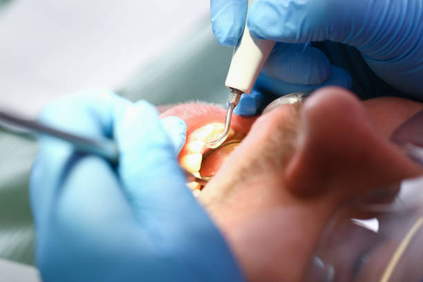 Best Same-Day Emergency Dentist in Breckinridge Center, KY